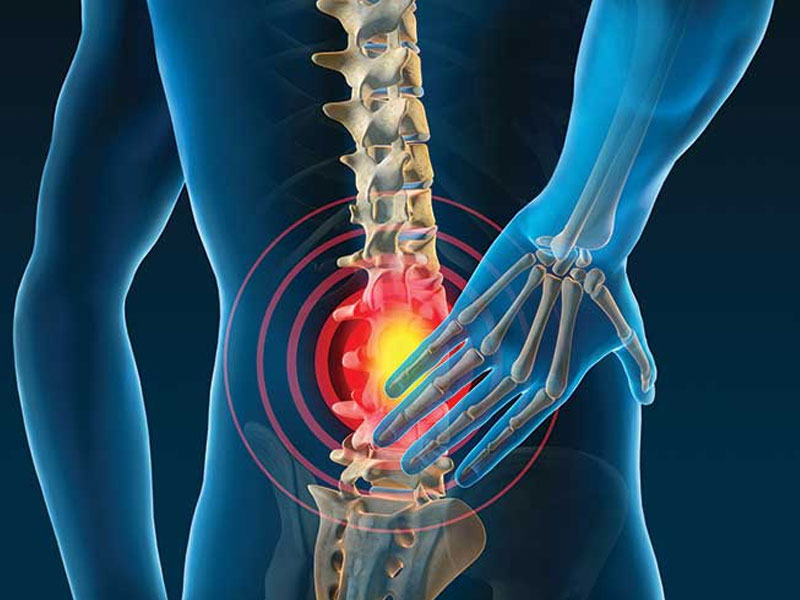 Sciatica and Lower Back Pain