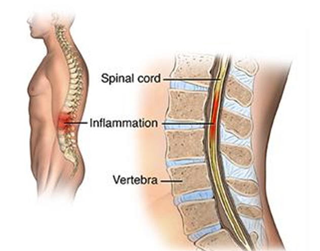 Balance Disorder Treatment