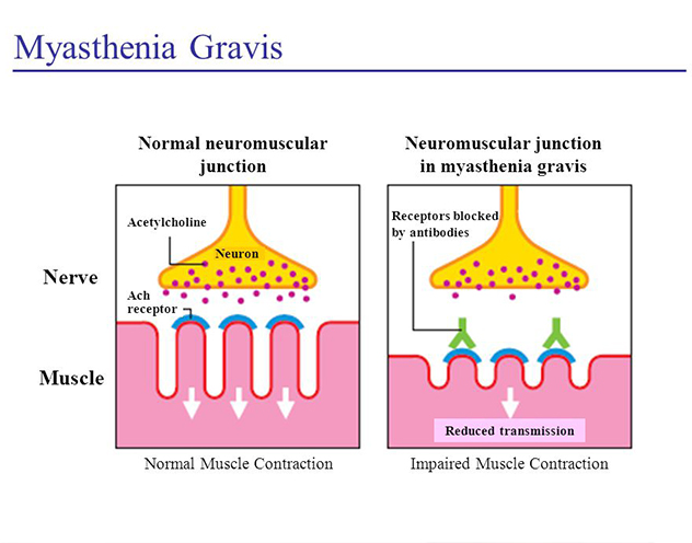 Meningitis & Encephalitis Care